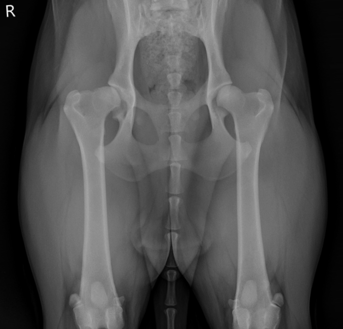 Hip Dysplasia
